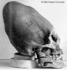 Un cráneo en forma de cono encontrada en Paracas / Perú