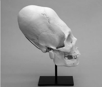 Cráneo llama do " Elongatus Australianus"