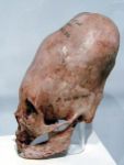 Paracas / Perú - otro antiguo cráneo en forma de cono